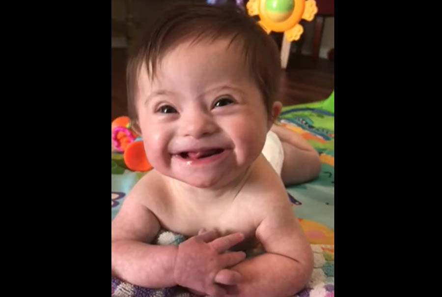 Viral video of adopted baby with Down syndrome highlights the gift of her life
