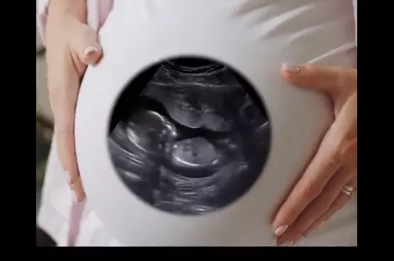 If wombs had windows