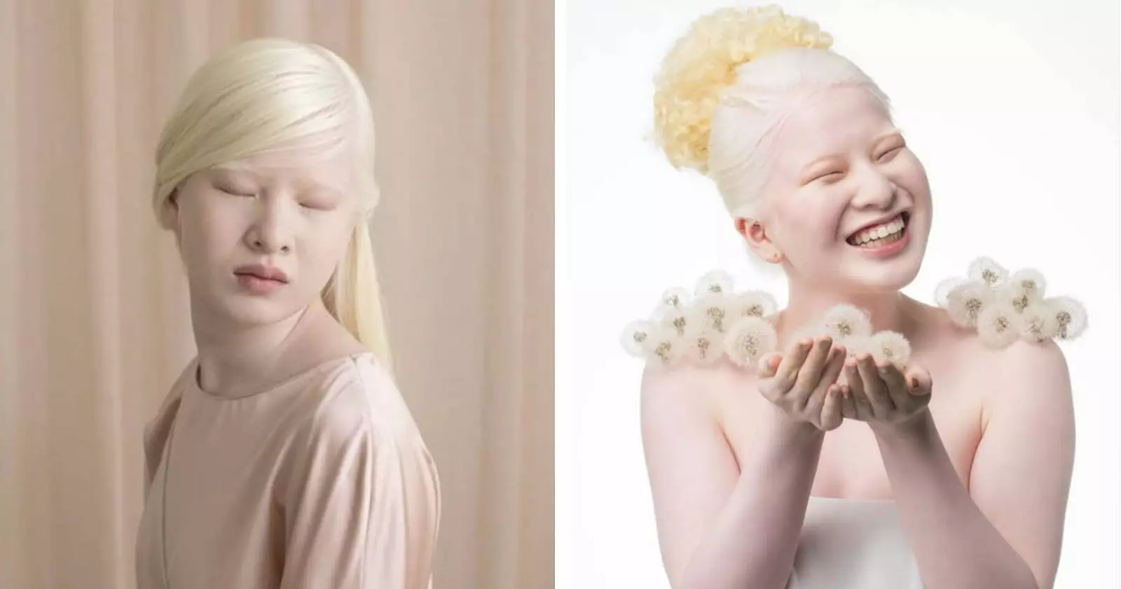 Girl abandoned as baby is now modelling for Vogue