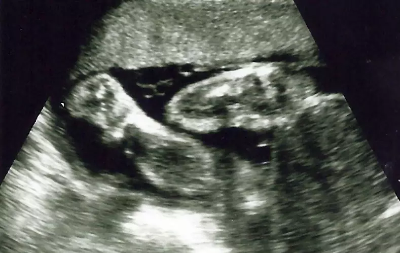 Alarming rise in abortions indicated by payments to doctors in first half of 2023