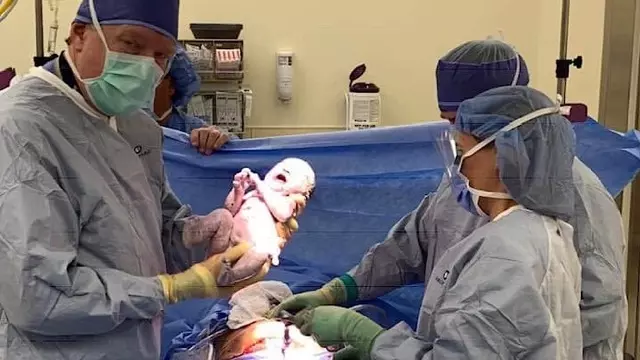 Stunning Photo of Baby Who Survived Abortion Captivates Internet