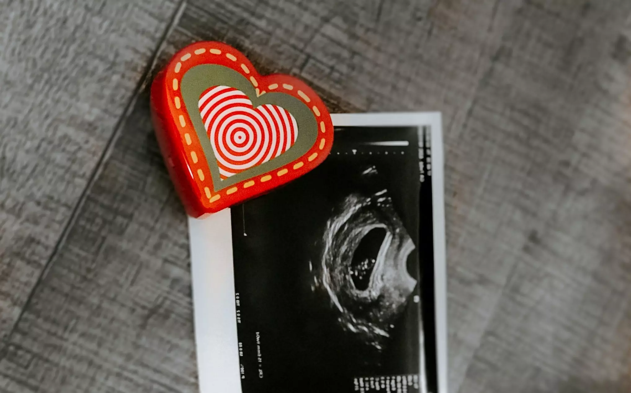 SCOTUS again allows Texas Heartbeat Act to stand as legal battle continues