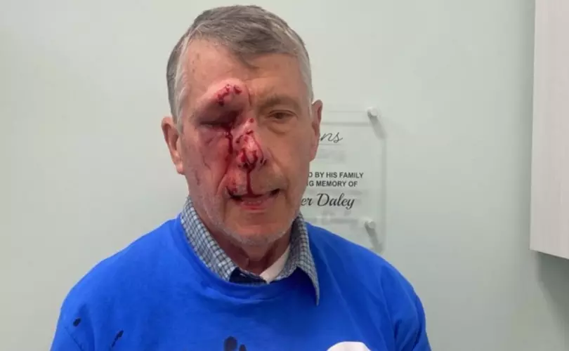 Two pro-lifers viciously assaulted outside Baltimore Planned Parenthood