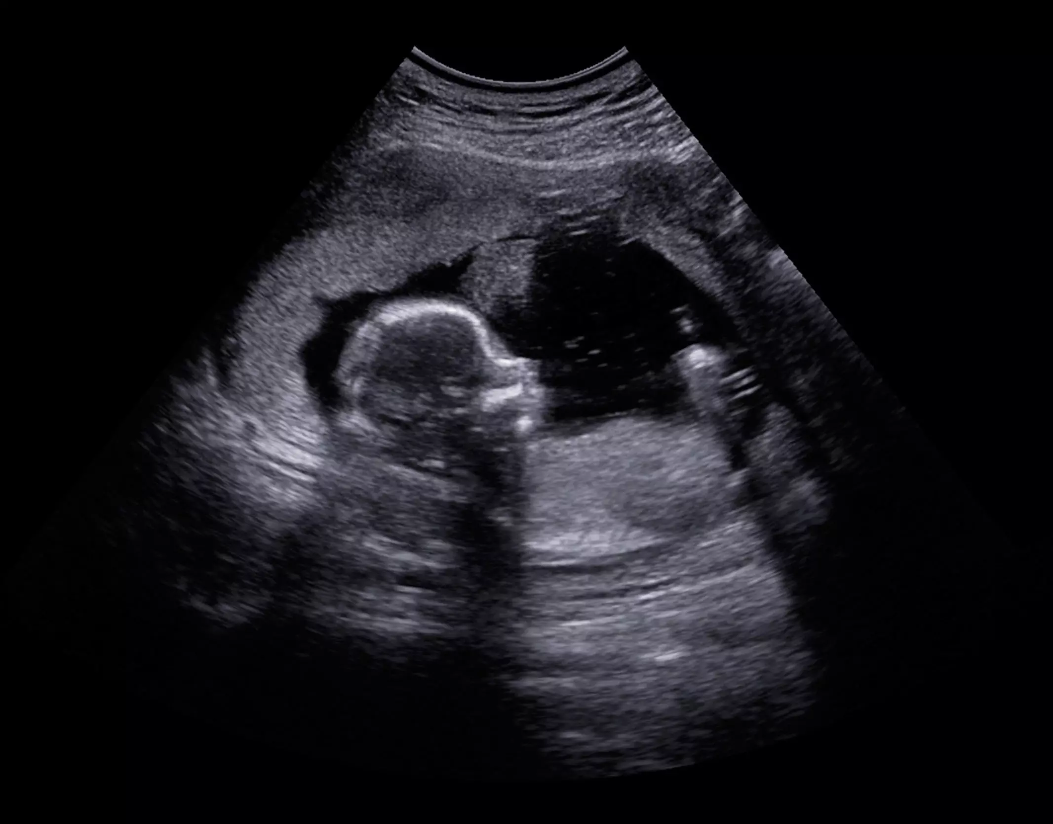 Abortionist ignores science in favor of pro-abortion propaganda