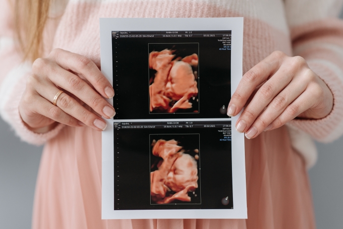 Love them both: 6 pro-life ways to help someone after a prenatal diagnosis
