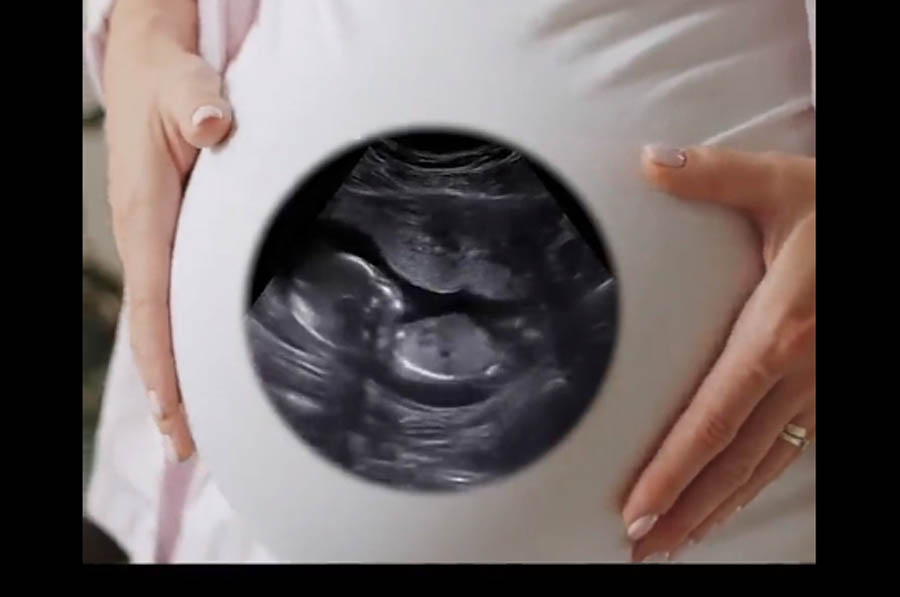 If wombs had windows