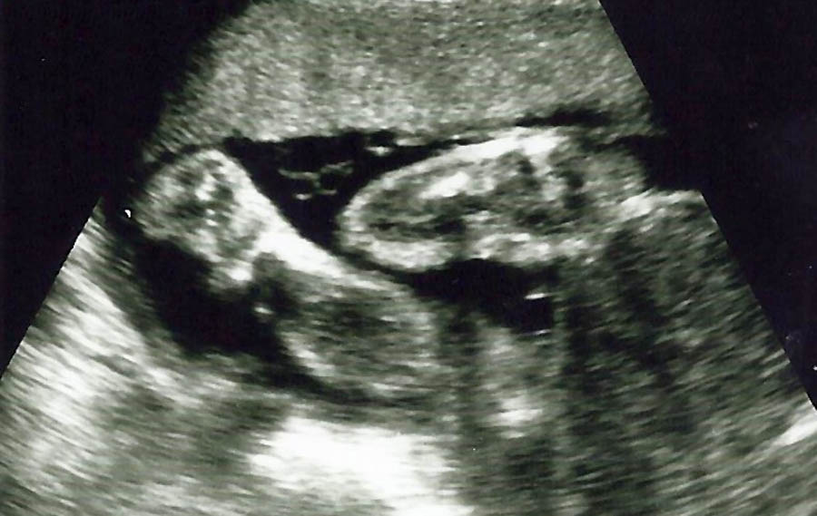 Alarming rise in abortions indicated by payments to doctors in first half of 2023