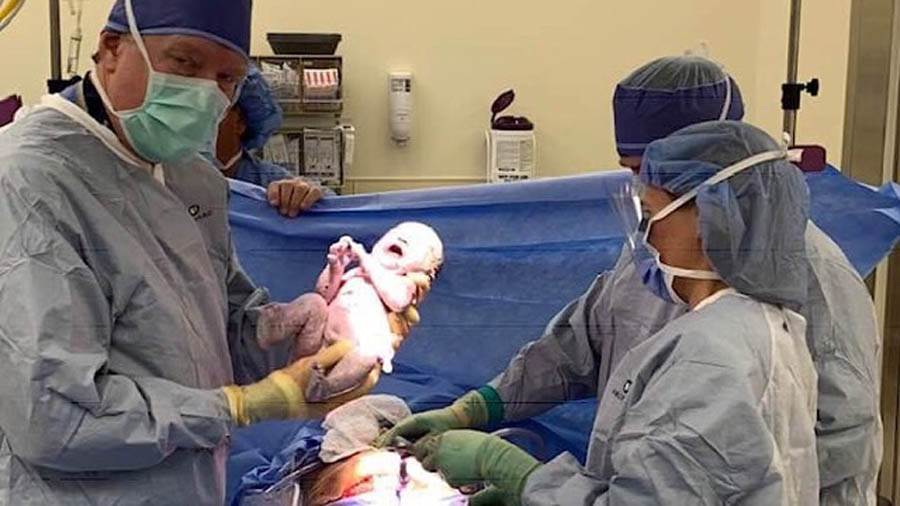 Stunning Photo of Baby Who Survived Abortion Captivates Internet