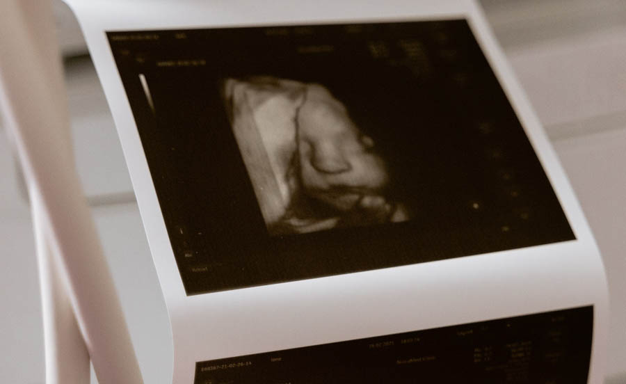 Indiana attorney general prevails in defending law requiring reporting of abortion complications