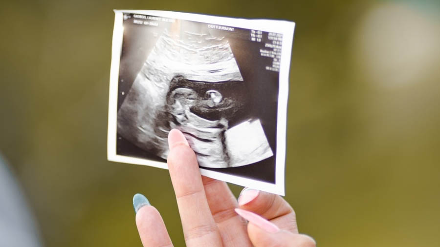 Austria: 73% say women are put under pressure to abort babies with disability